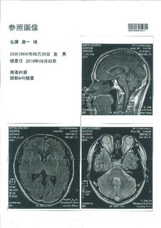 20090902脳MRI.jpg